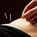 Complementary & Alternative Medicine (CAM) image